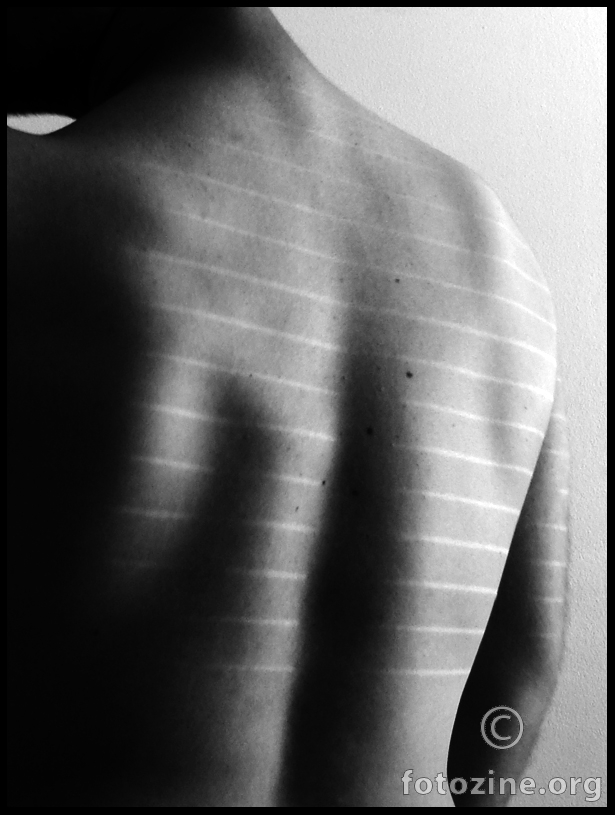 Lines all over me...