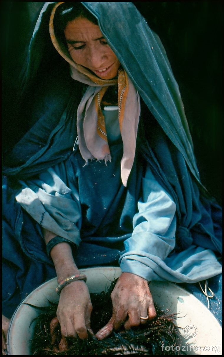 Tuareg Sahara - odstranjivanje podkožnog trulastog mesa 