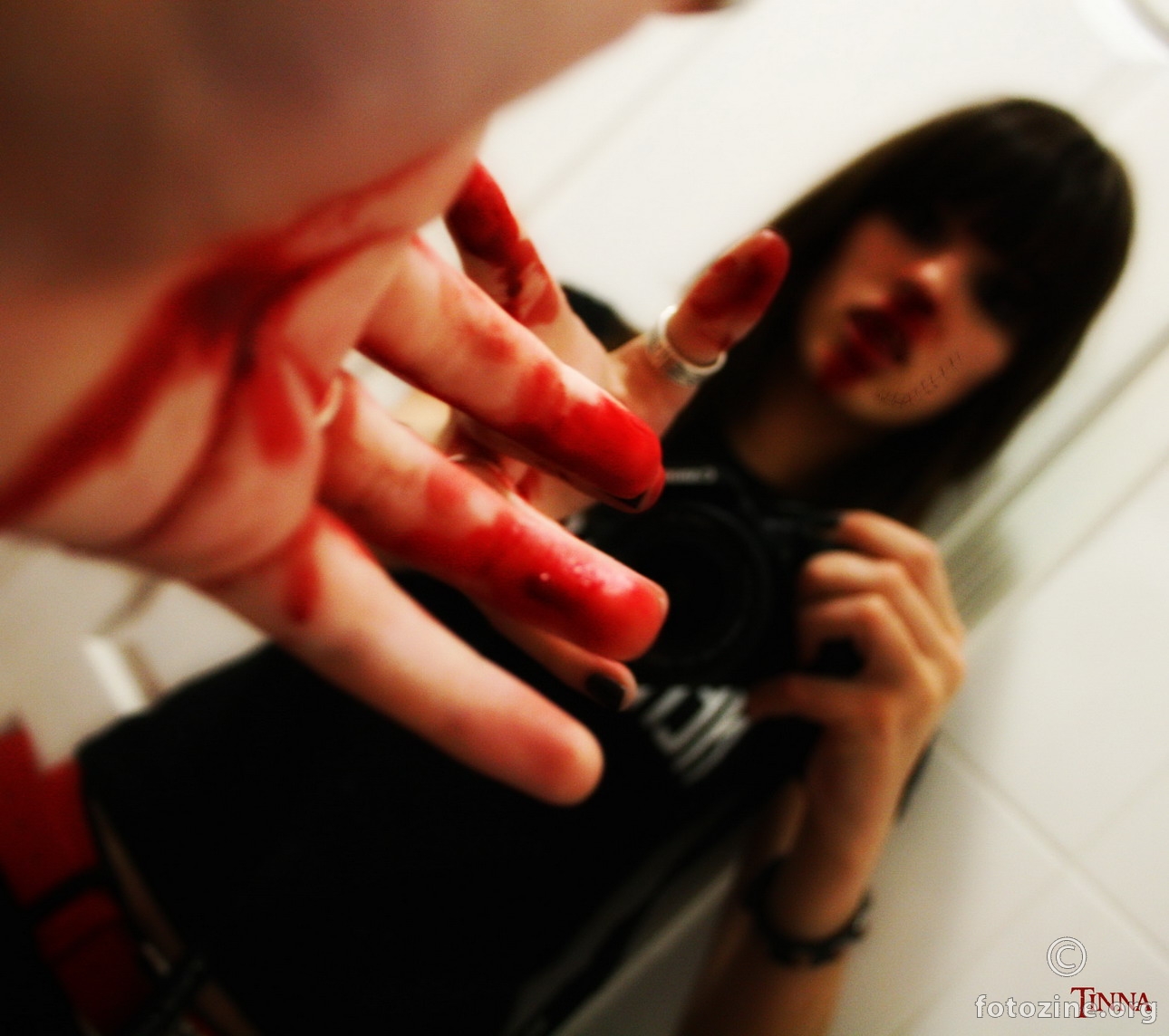 Bleeding to death
