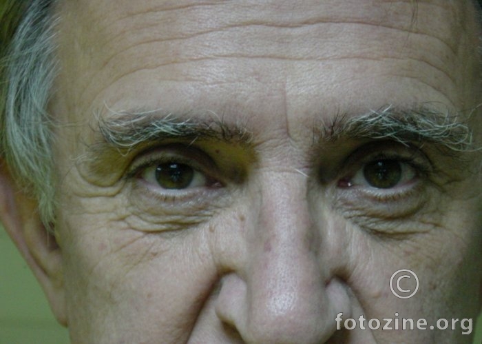 dio_nosa